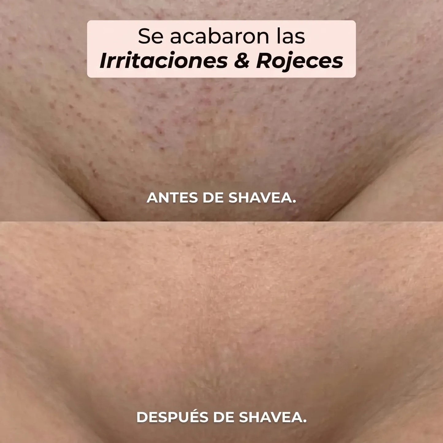 Maquinilla 2 en 1 para Bikini y Cuerpo Shavea™